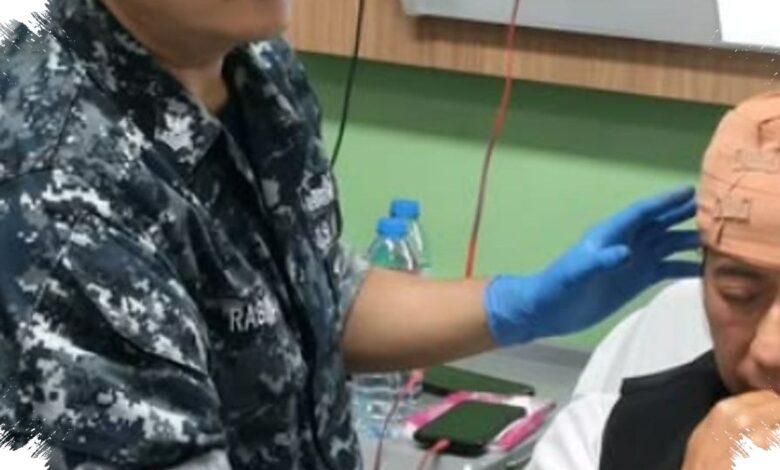Benturan di Bandung Membuat Yukie Dirawat, Keluarga Penabrak Berdamai